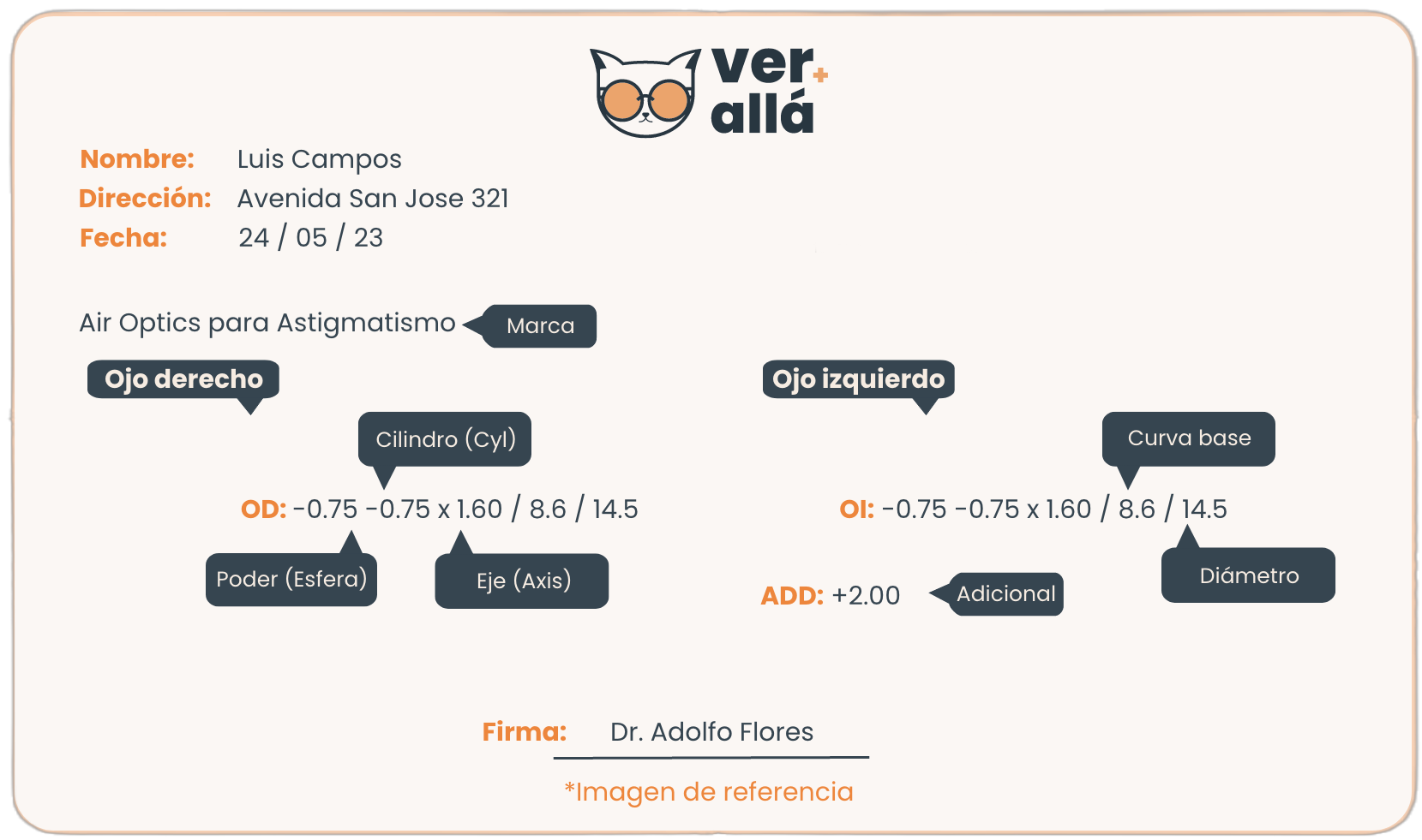 receta lentes de contacto